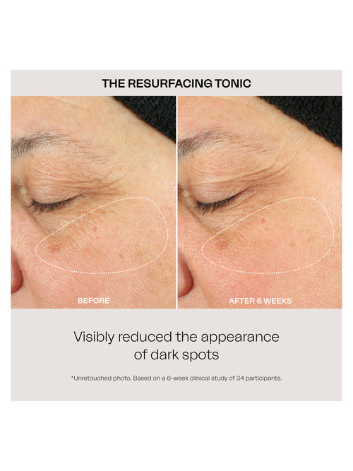 Resurfacing Tonic